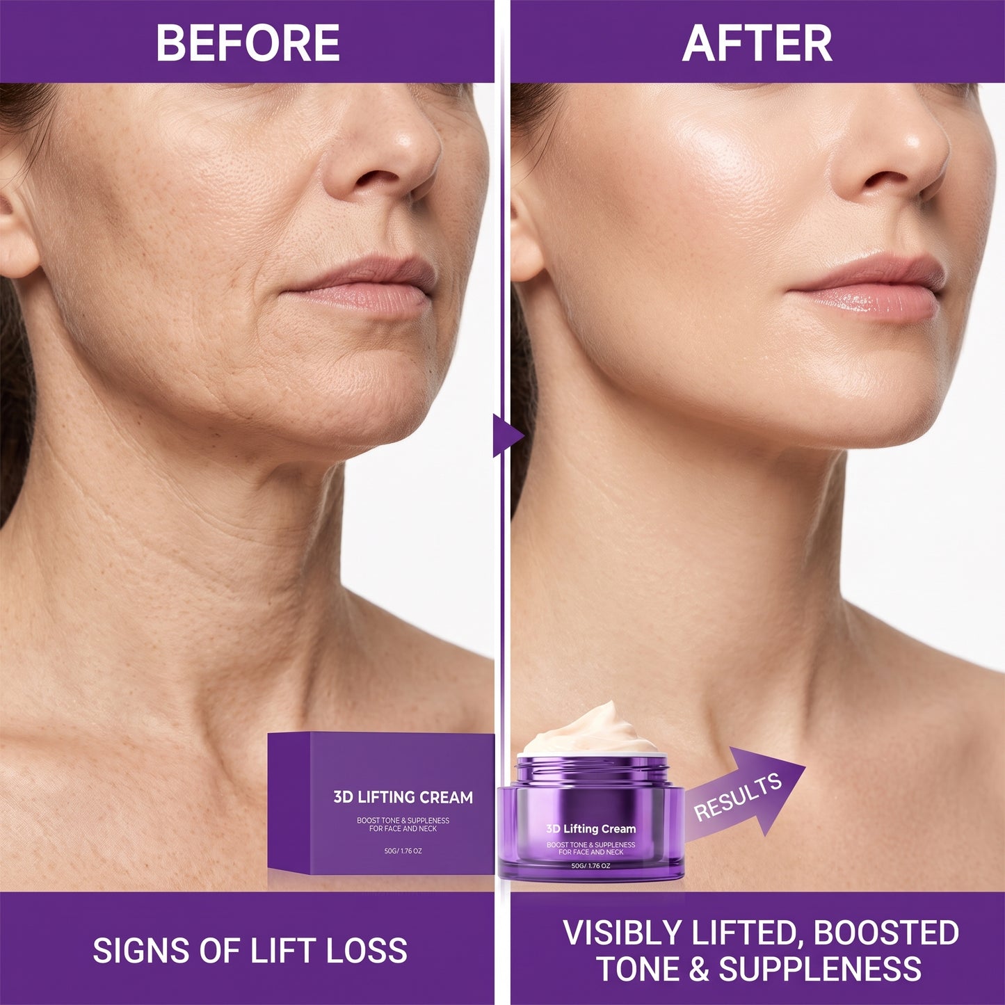 ProBioDerm 3D Lifting Face & Neck Cream